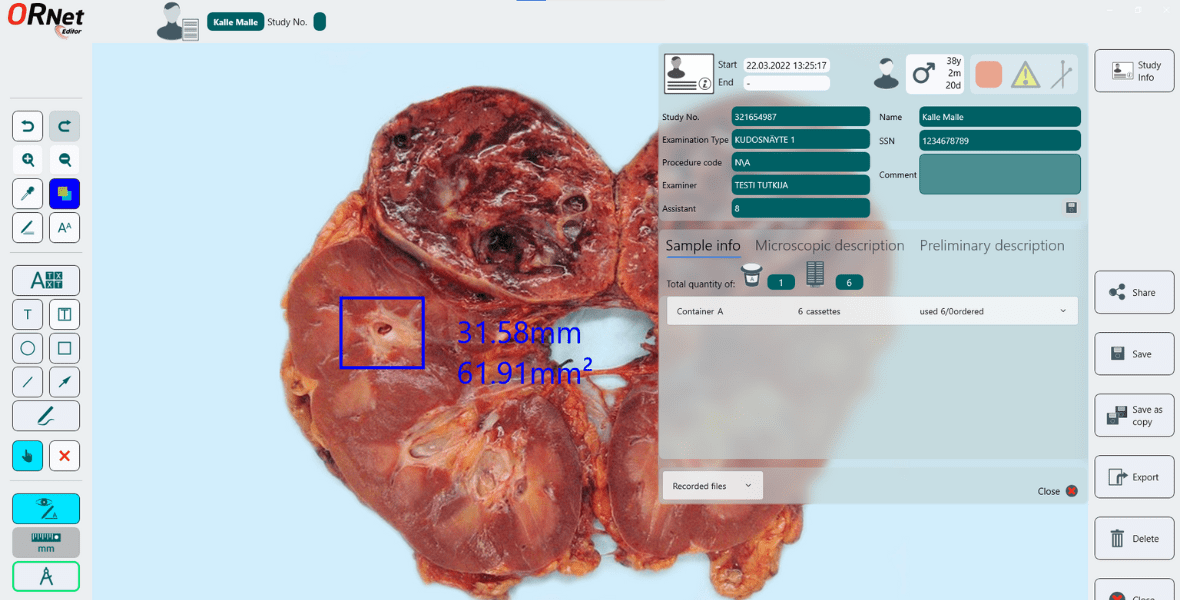 Gross Pathology An In Depth Overview ORNet