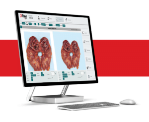 compare pathology and OR image with ORNet Editor