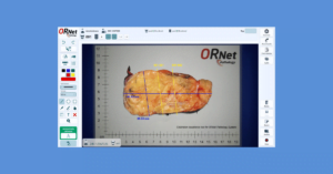 ORNet Pathology for Gross Pathology Imaging