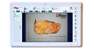 ORNet Pathology gross sample imaging