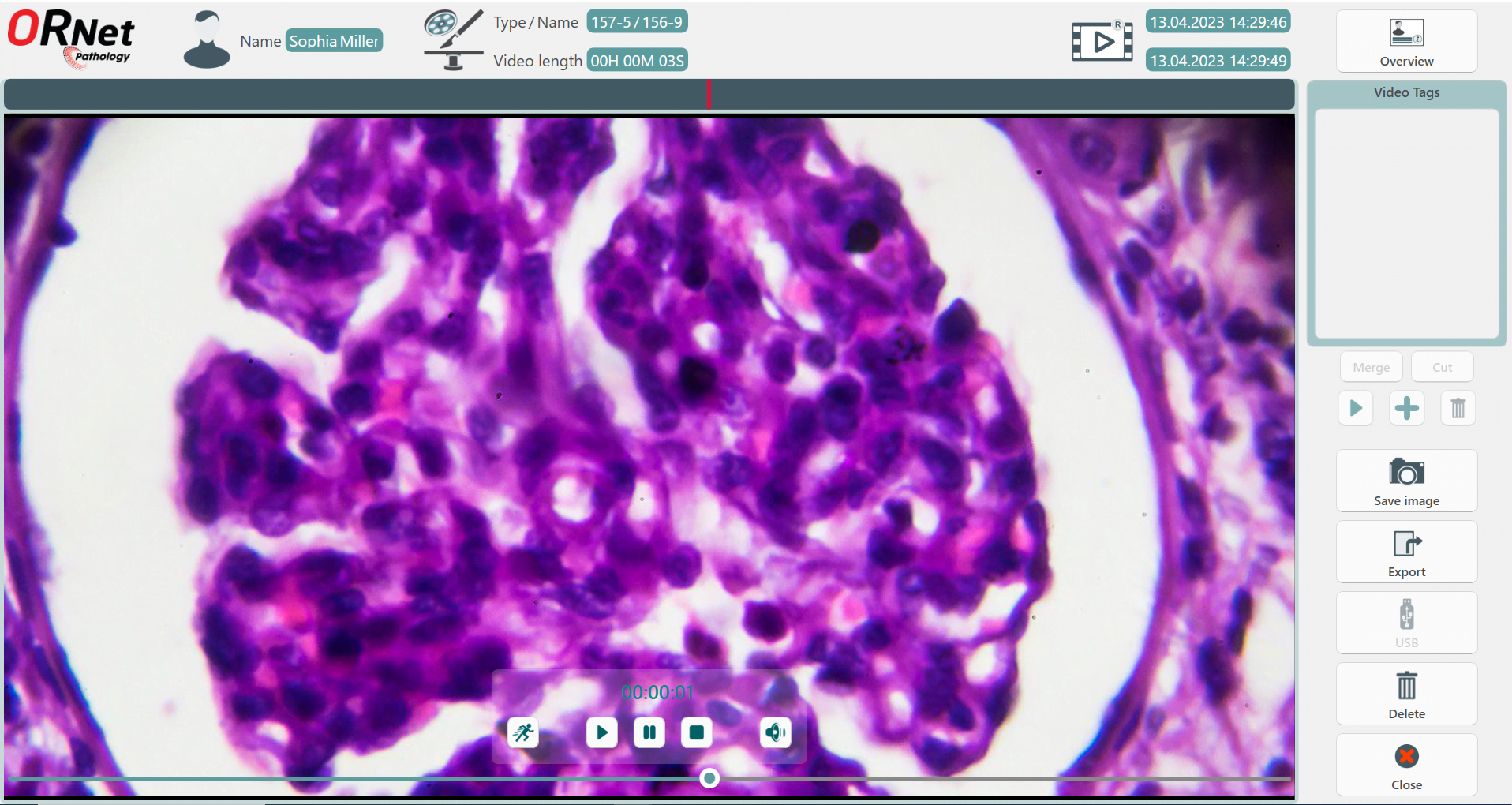 ORNet Pathology video editor for grossing videos