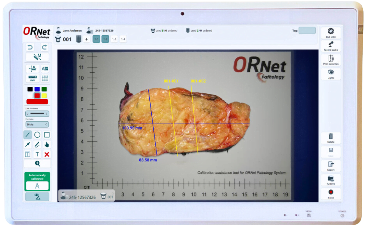 ORNet Pathology with Macro Pathology Sample Documentation